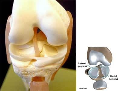 torn meniscus in a flexed knee 