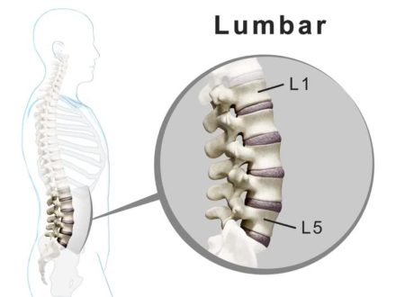 showing side view of the entire lumbar including the L2-L3 segment
