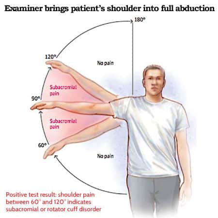 shoulder ranges of motion and causes of pain shoen
