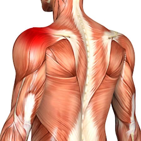muscles of the neck, shoulders, and upper back