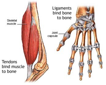 tendonitis of the wrist 