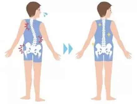 illustration of man with scoliosis and back pain