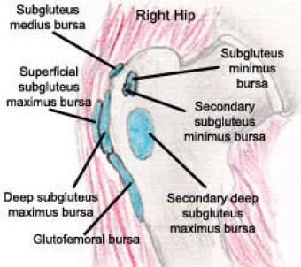 burease of the hip shown