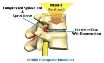 effects of axial load bearing shown