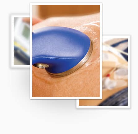 Ultrasound Therapy 