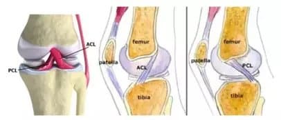 anatomy of knee joint and ligament including ACL & PCL