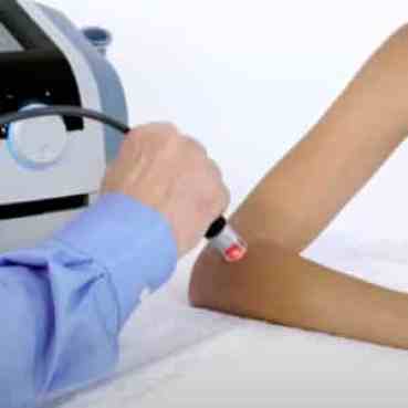 High intensity laser therapy on elbow shwon
